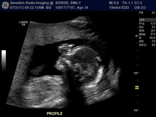 Profile of Baby Sorge